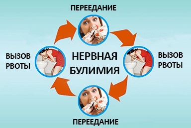 Лечение булимии в Боровске